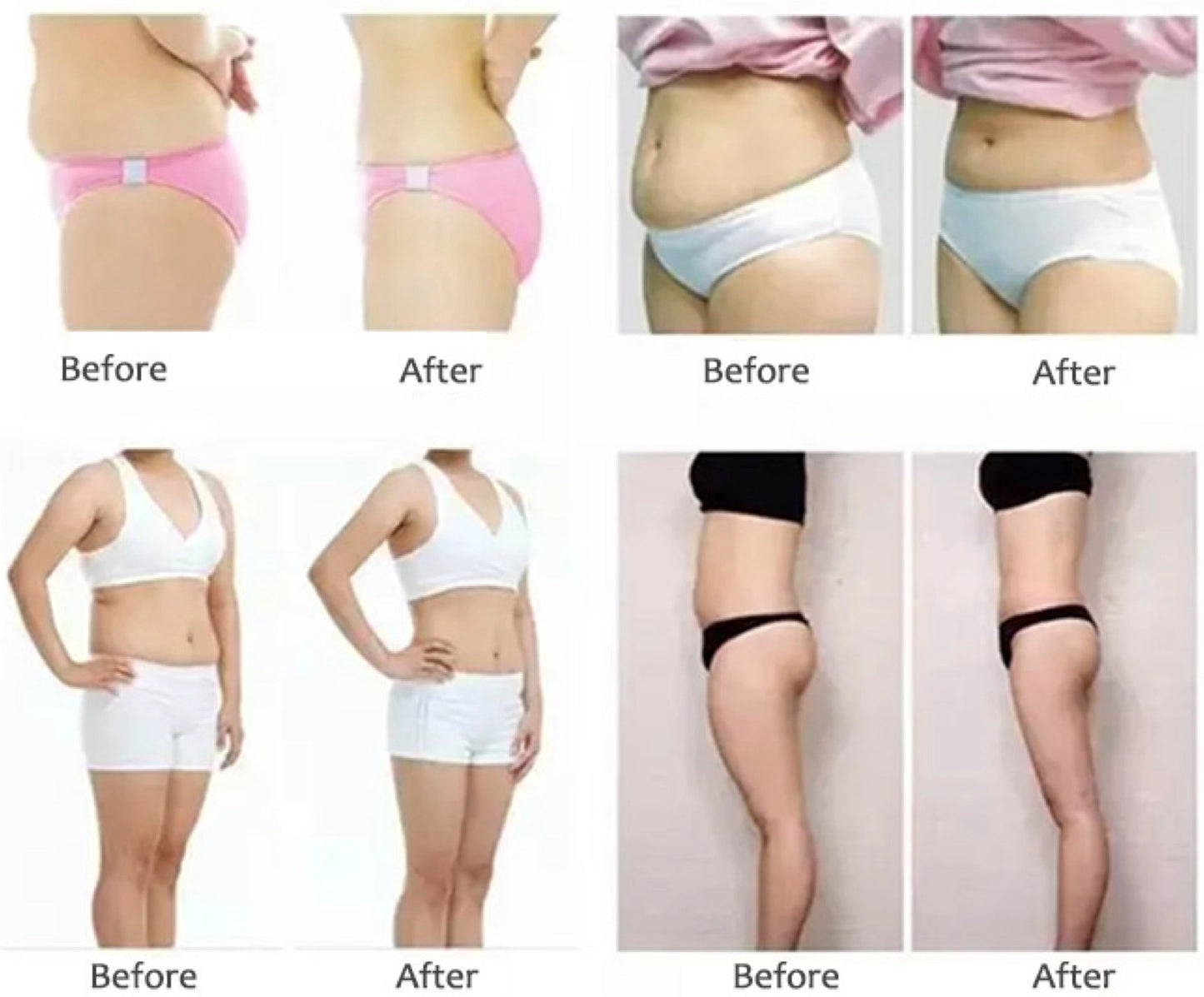 Velashape Slimming Face Lifting Massage Machine